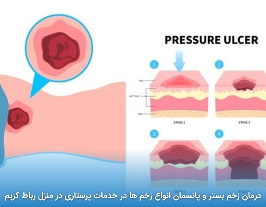 علائم و نشانه‌ های هشدار ایجاد زخم بستر